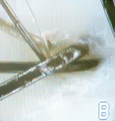 専用マイクロスコープによる
毛髪・毛根診断画像